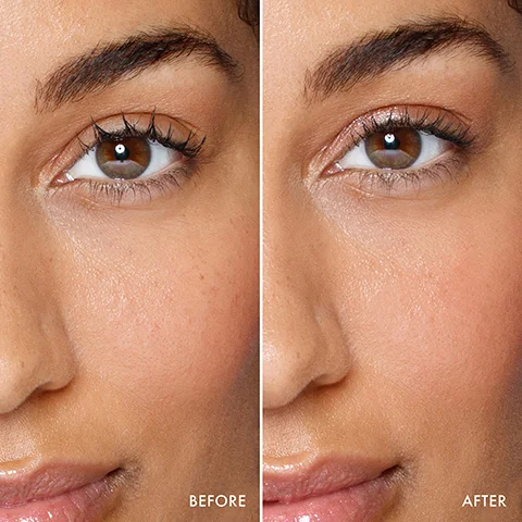 Image 1 - A close-up image shows a womans face divided into two halves, with the left labeled as BEFORE showing uneven skin tone and texture, and the right labeled as AFTER displaying smoother, more even skin.