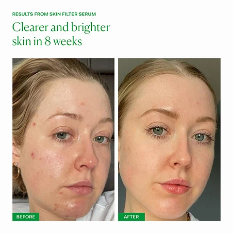 image 1, results from skin filter serum, clearer and brighter skin in 8 weeks. before and after. image 2, AHAs - glycolic, lactic, mandelic, malic, tartaric and citric acids unglue dead skin cells to smooth and brighten. bakuchiol and rambutan - plant based alternative retinols deliver results with no irritation. hyaluronic acid - holds up to 1000 times its weight in water to deeply hydrate. image 3, dullness, pigmentation and occasional breakouts. inner skin filter - for anyone who is looking to brighten their skin and reduce dark marks or pigmentation. clinically proven results in 60 days, one capsule daily with food. outer skin filter serum - for anyone looking to improve skin texture, brighten skin, reduce dark marks and reduce fine lines. apply 2-3 pumps to clean, dry skin after cleansing in the PM. follow with barrier culture moisturiser. image 4, old packaging vs new packaging. as our new packaging phases in sustainably, you may receive either out old or new jar and box. inside the jar it's the same formula you know and love.
