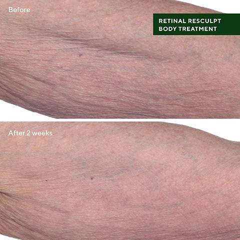 Image 10 - A hand holds a green jar of Murad Retinal ReSculpt Body Treatment with a silver lid, and above it, green text reads WHERE TO APPLY: + Buttocks + Thighs + Stomach + Arms + Chest + Elbows + Knee area; the jar label further displays Murad. RESURGENCE™ Retinal ReSculpt Body Treatment Traitement corporel Retinal ReSculpt with targeted encapsulation tech + visibly firming lipids avec technologie dencapsulation ciblée + lipides visiblement raffermissants. Image 4 - A before and after comparison shows an arm with visibly wrinkled skin in the top image and smoother skin with fewer wrinkles in the bottom image, with text that reads Before, After 2 weeks, and RETINAL RESCULPT BODY TREATMENT. Image 6 - A dark green cosmetic jar with a metallic silver lid sits on a green surface against a green background, featuring text that reads Murad. RESURGENCE™ Retinal ReSculpt Body Treatment Traitement corporel Retinal ReSculpt with targeted encapsulation tech + visibly firming lipids avec technologie d’encapsulation ciblée + lipides visiblement raffermissants, alongside three bullet points listing benefits as ENCAPSULATED RETINAL Lifts, firms and boosts cell turnover, MILK THISTLE & BEARBERRY EXTRACT Smooth and tone, mimicking the effects of exercise, and SHEA BUTTER, AVOCADO EXTRACT & SQUALANE Hydrate and smooth (cellulite, dimpled skin & stretch marks). Image 7 - A persons glutes and lower back are shown, with one hand holding a green jar of Murad product, and a swipe of cream on the glute, accompanied by visible text: SMOOTHS, LIFTS AND TONES BODY SKIN IN JUST 4 WEEKS* Murad. RESURGENCE™ Retinal ReSculpt Body Treatment Traitement corporel Retinal ReSculpt with targeted encapsulation tech + visibly firming lipids avec technologie dencapsulation ciblée + lipides visiblement raffermissants *Results based on an 8-week clinical study with 34 participants. Image 8 - A persons brown-toned body is shown with a green Murad Retinal ReSculpt Body Treatment jar on it, alongside text that reads LIFTS & TIGHTENS In just 4 weeks, FIRMS & SMOOTHS In just 4 weeks, REDUCES STRETCH MARKS In just 8 weeks, with a disclaimer *Results based on an 8-week clinical study with 34 participants, and jar text Murad. RESURGENCE™ Retinal ReSculpt Body Treatment Traitement corporel Retinal ReSculpt with targeted encapsulation tech + visibly firming lipids avec technologie dencapsulation ciblée + lipides visiblement raffermissants.