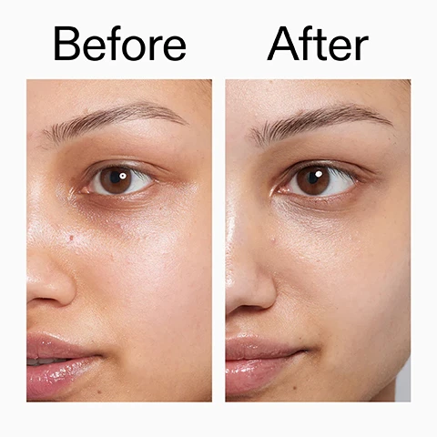 Image 1 - A persons face is shown in a before and after comparison, with the before image on the left displaying darker under-eyes and the after image on the right showing brightened under-eyes and more even skin tone, with the text Before and After above. Image 2 - A before and after comparison of a womans face showing a reduction in wrinkles around the eye and cheek in the after image. Before After Image 3 - A person with light skin applies a yellowish gel-like product under their eye, next to text that states: Clinically proven to reduce skin redness by 22% after just 2 weeks* Improves hydration levels by up to 160% after 1 hour. Helps reduce the appearance of puffiness and dark circles. Clinically proven to firm skin and reduce fine lines in 28 days** *4-week independent consumer study of 22 people under dermatological and ophthalmological control **4-week clinical study of 20 people. Image 4 - A person with their eyes closed, gently rubbing a cleansing product on their face with both hands, their skin appearing moist, with a nose piercing visible, next to text that reads Why we love Oat Cleansing Balm Melts waterproof makeup and SPF. Rich, buttery texture. Suitable for all skin types, even sensitive. Image 5 - A close-up of a smiling womans face with radiant, hydrated skin and a gap between her front teeth is shown above the text Why we love Ectoin Hydro-Barrier Serum, Hydrates and strengthens the skin barrier, Lightweight and non-sticky, Helps add bounce and firm skin. Image 6 - A person with short dark hair looks upwards, gently pulling down the skin under their left eye with one hand while holding a white tube of eye cream near their mouth with the other, the tube labeled CAFFEINE EYE CREAM Helps reduce the appearance of tired eyes Aide à réduire lapparence des yeux fatigués. Image 7 - Close-up of a persons eyes and nose area with wrinkles around the eyes and a hand touching the cheek, alongside the text Why we love Bio-Active Ceramide Moisturiser, Smooths, firms and deeply hydrates, Strengthens the barrier, Rich, non-greasy formula. Image 8 - A white background image shows a list of four steps for a morning skincare routine with a creamy white product swirl on the right, displaying the text: How to layer Reset Bundle (AM) 1 Oat Cleansing Balm MASSAGE ONTO DRY SKIN TO BREAK DOWN MAKEUP, SPF AND IMPURITIES. RINSE WELL. 2 Ectoin Hydro-Barrier Serum APPLY A PEA-SIZED AMOUNT TO FACE AND NECK. LET IT FULLY ABSORB. 3 Caffeine Eye Cream GENTLY PAT A SMALL AMOUNT UNDER THE EYES USING YOUR RING FINGER. 4 Bio-Active Ceramide Moisturiser LAYER ON TOP TO HELP SUPPORT SKIN REPAIR AND BOOST BARRIER FUNCTION. Image 9 - Four The INKEY List skincare products are displayed on a black shelf: an Oat Cleansing Balm tube (5.07 US fl. oz. / 150ml e) labeled Helps remove makeup and cleanse sensitive skin. Aide à démaquiller et nettoyer les peaux sensibles, with a red CEW UK BEAUTY AWARD WINNER 2024 badge; an Ectoin Hydro-Barrier Serum pump bottle (1 US fl. oz. / 30ml e); a Caffeine Eye Cream tube (0.5 US fl. oz. / 15ml e) with a black GET GLOSS BEAUTY AWARDS WINNER 2024 badge; and a Bio-Active Ceramide Repairing and Plumping Moisturizer jar (1.7 US fl. oz. / 50ml e) labeled Visibly smooths and firms skin, whilst strengthening skin barrier, with a red CEW UK BEAUTY AWARD WINNER 2024 badge.